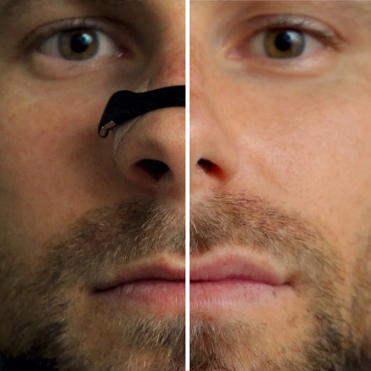 Oxigeno+ | Dilatador nasal